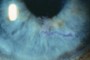 Image showing rose bengal staining