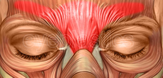 Illustration of Botulinum toxin with watermark